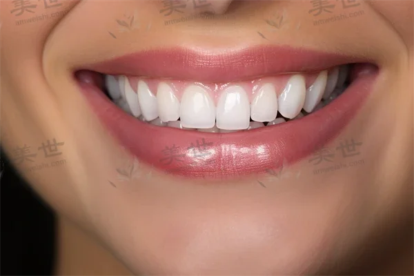 超值优惠！湖北黄石华玉口腔门诊部地包天治疗现仅需3500元起，原价5000元起，活动时间有限，欢迎前来咨询！