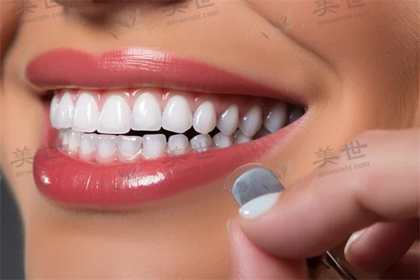 泸州江阳微笑口腔门诊部牙周治疗价目表：原价888元起，现优惠仅需688元起。让您的口腔健康与实惠相伴，欢迎前来体验！