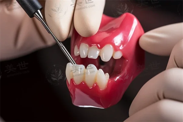 武汉隐乐口腔门诊部口腔修复优惠：原价2000元起，现仅需1500元起，助您轻松实现口腔健康与美丽的双重愿望！