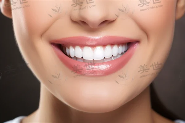 矫正牙齿是否需要进行根管治疗？了解牙齿矫正与根管治疗的关系