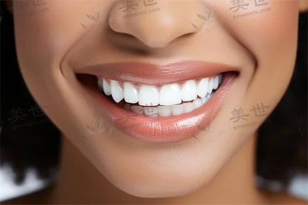 北京中鸿口腔门诊部推出超值洗牙优惠，原价380元起现仅需299元起，助您轻松拥有健康迷人的笑容！