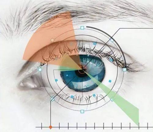 广州越秀爱尔眼科医院医生团队：技术领跑、口碑爆棚的底气