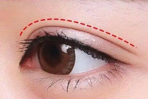 杨子逸医生擅长领域