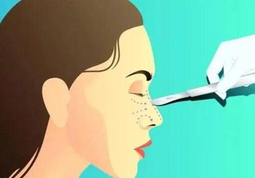 深圳熹尔整形医院口碑评价