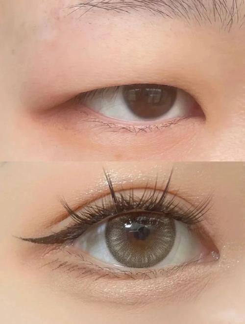 浙江嘉兴盛美医美预约挂号方式：