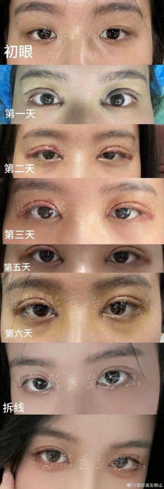 深圳熹尔整形医院医生名单及擅长领域