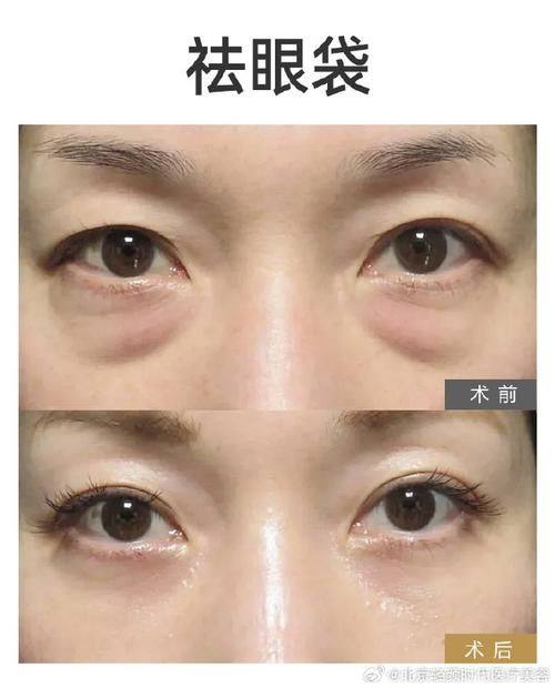 付花香医生怎么预约?