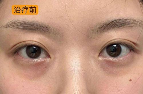 宜昌博美美容诊所怎么样？