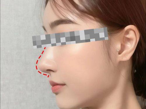 邯郸市邯山区妙安阁美容修复医院擅长项目：