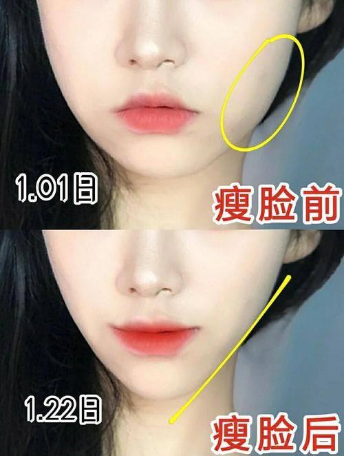 郑绍埏医生口碑评价