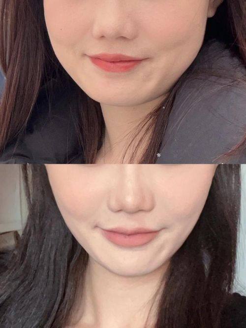 江阴伊莱诺美格尔医疗美容诊所地址电话及营业时间