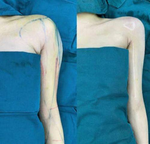 郑泰成医生口碑评价