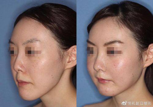 郑绍埏医生技术优势