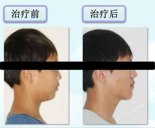 郑绍埏医生怎么预约？