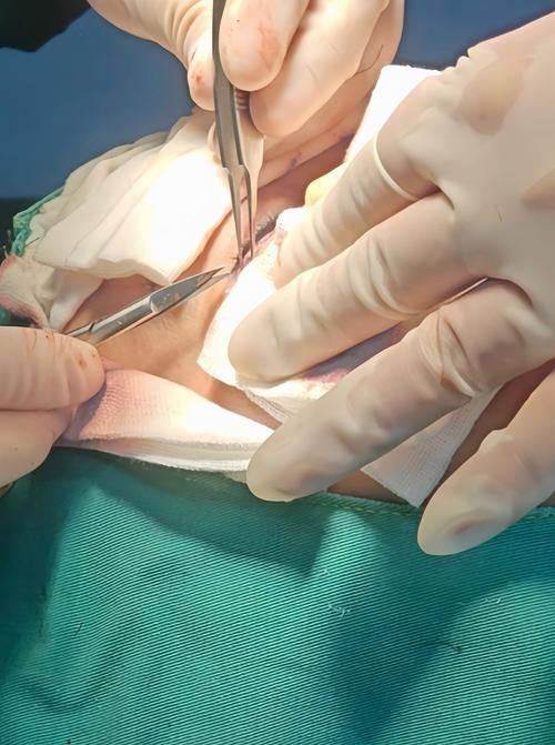 郑绍埏医生擅长领域