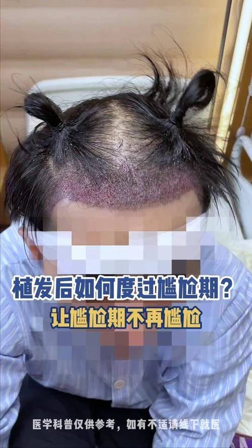 游凤军 医生怎么预约