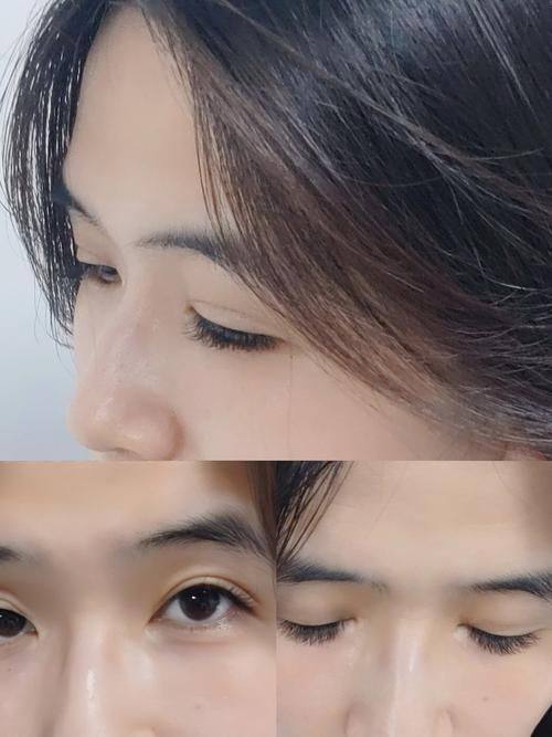 杨性奎医生技术优势