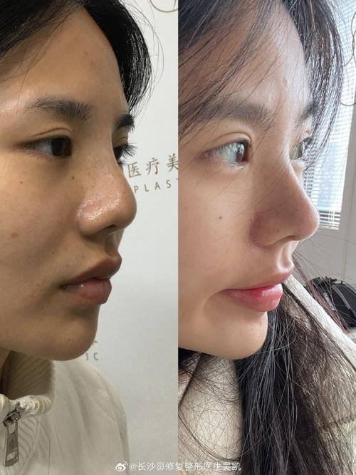 北京美之星整形医疗美容医院怎么样？