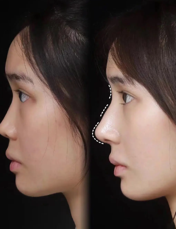 北京美之星整形医疗美容医院预约挂号方式