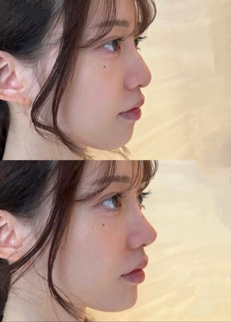 深圳熹尔整形医院怎么样