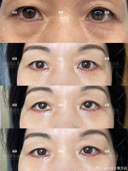 日本日比谷美容外科医院口碑评价