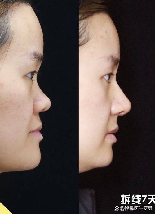 铜仁韩美时光医疗美容门诊部价格表：