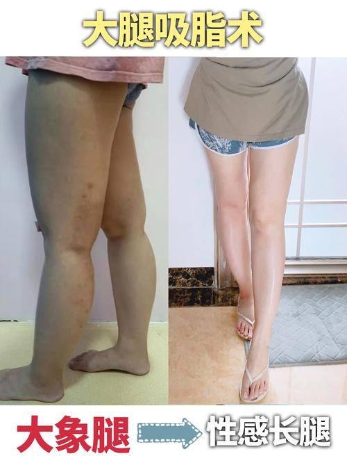 益阳爱思特整形医院怎么样？