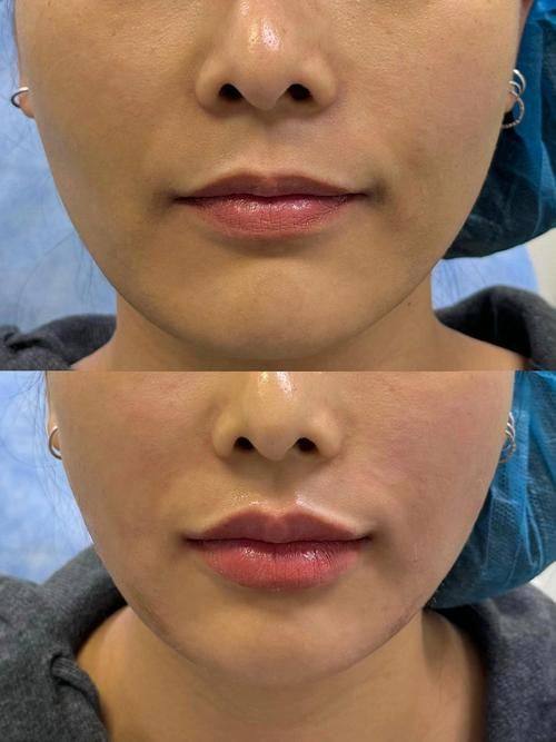 西安漾思佳美雁塔医疗美容诊所价格表