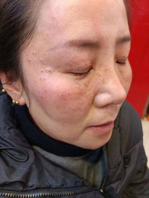 邢台尚美整形医院医生名单及擅长领域：