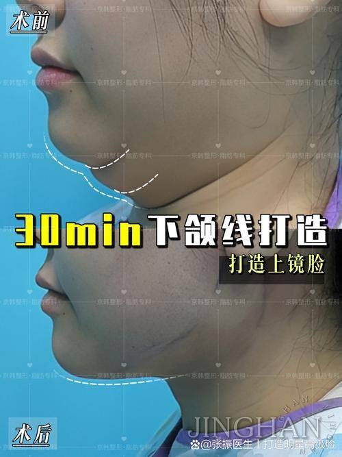 邢台尚美整形医院擅长项目：