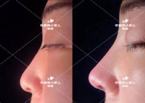 成都可纳儿整形医疗美容诊所口碑评价