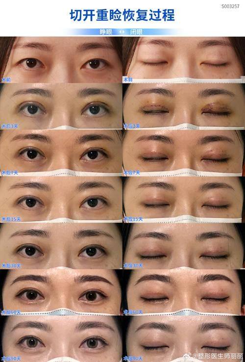 北京星诺整形医院价格表