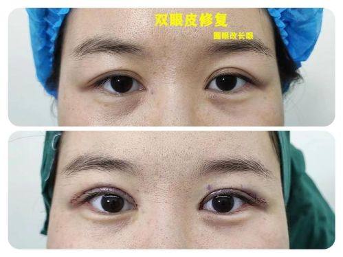 克拉玛依区希美整形医疗美容综合门诊部地址电话及营业时间