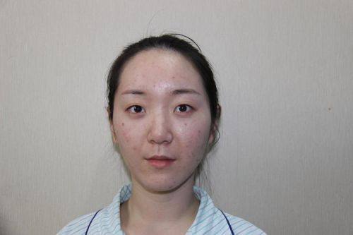 克拉玛依区希美整形医疗美容综合门诊部预约挂号方式