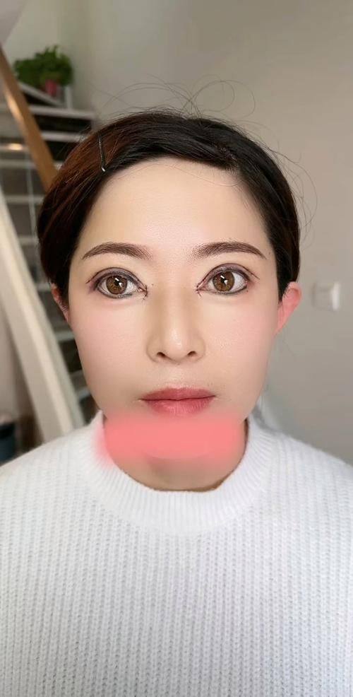 烟台安吉拉整形医院口碑评价