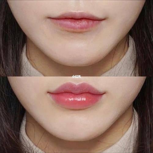 成都可纳儿整形医疗美容诊所擅长项目：