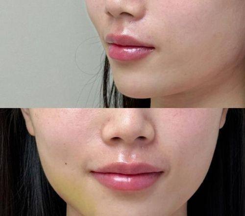 成都可纳儿整形医疗美容诊所预约挂号方式