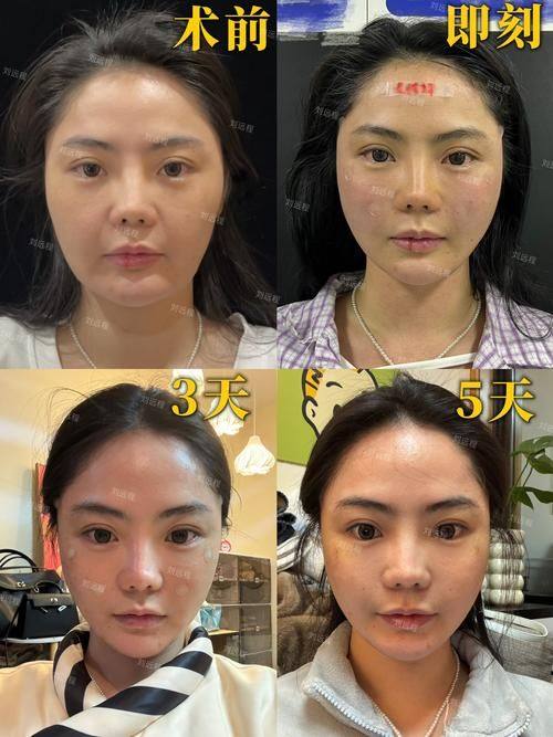 郑州黄大同整形医院预约挂号方式