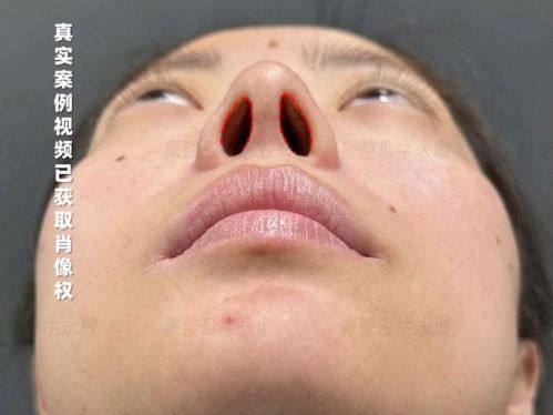 烟台安吉拉整形医院价格表