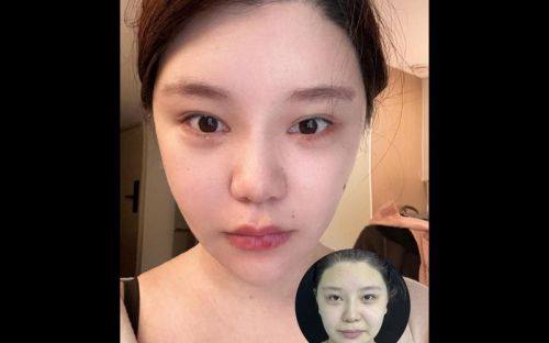 呼和浩特微美整形美容门诊部预约挂号方式