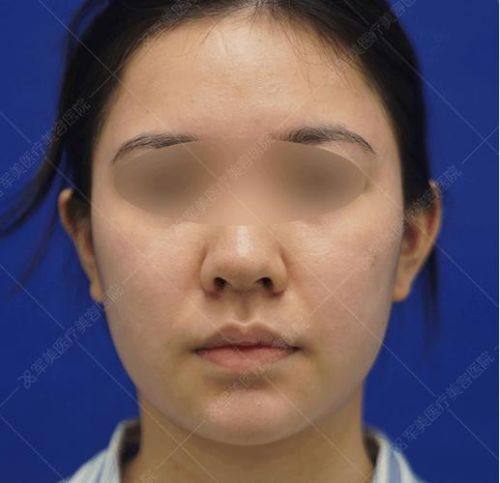 呼和浩特微美整形美容门诊部价格表