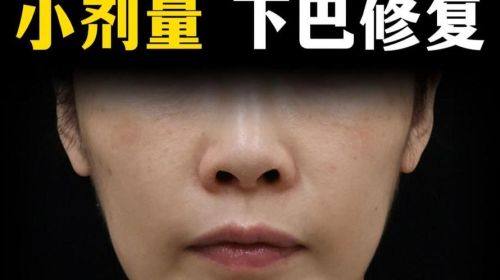 郑州黄大同整形医院地址电话及营业时间