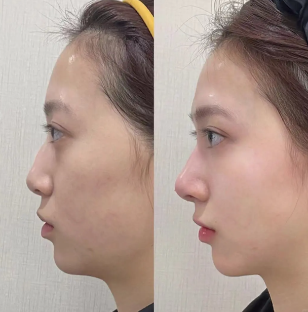 北京星诺整形医院预约挂号方式