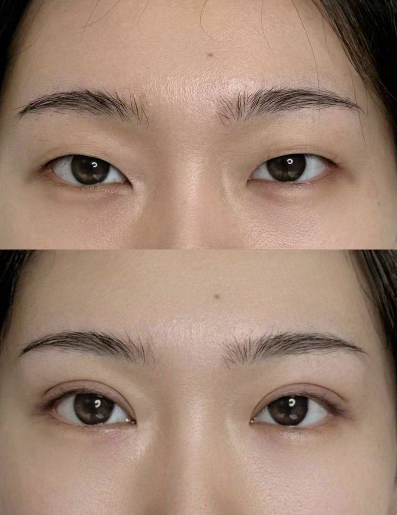 克拉玛依区希美整形医疗美容综合门诊部怎么样？