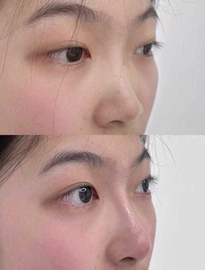 郑州黄大同整形医院价格表