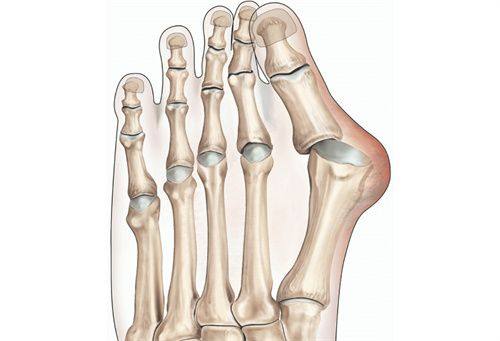 三、做完双眼皮手术的饮食禁忌与调理