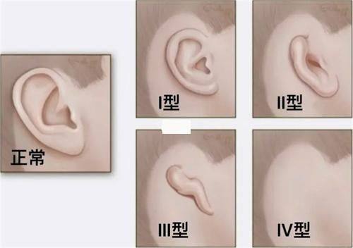 五、刚打完瘦脸针后的成效观察与异常处理