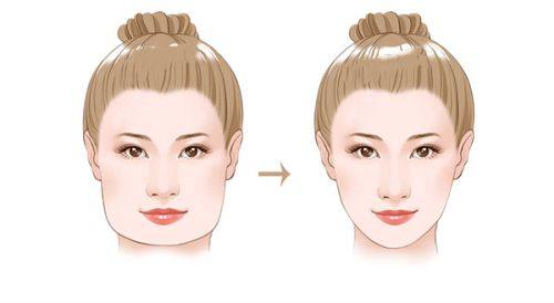 五、黑眼圈眼袋重度？先辨明成因再对症改善