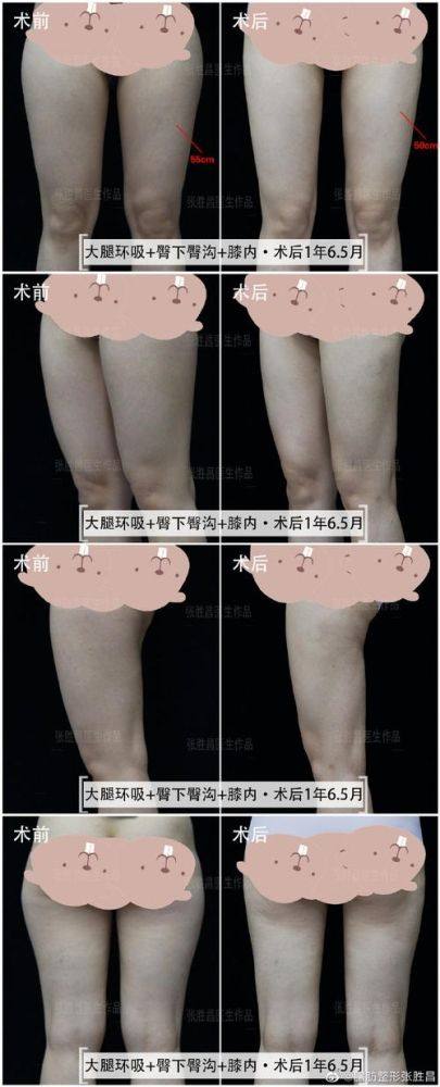 青海西宁交通医院整形美容科价格表