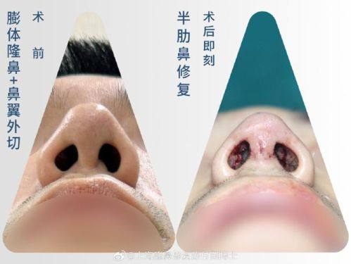 大连芳华医美门诊口碑评价：